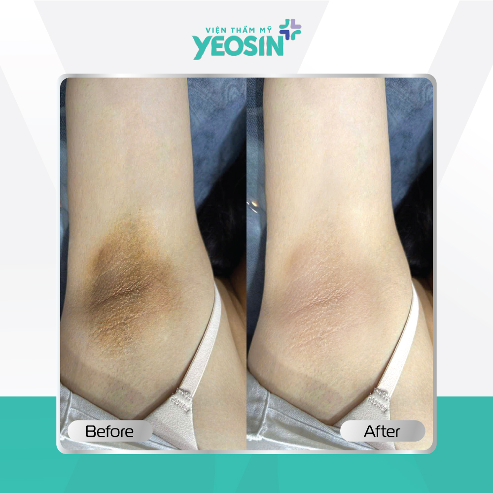 Hình fb từ khách hàng 04