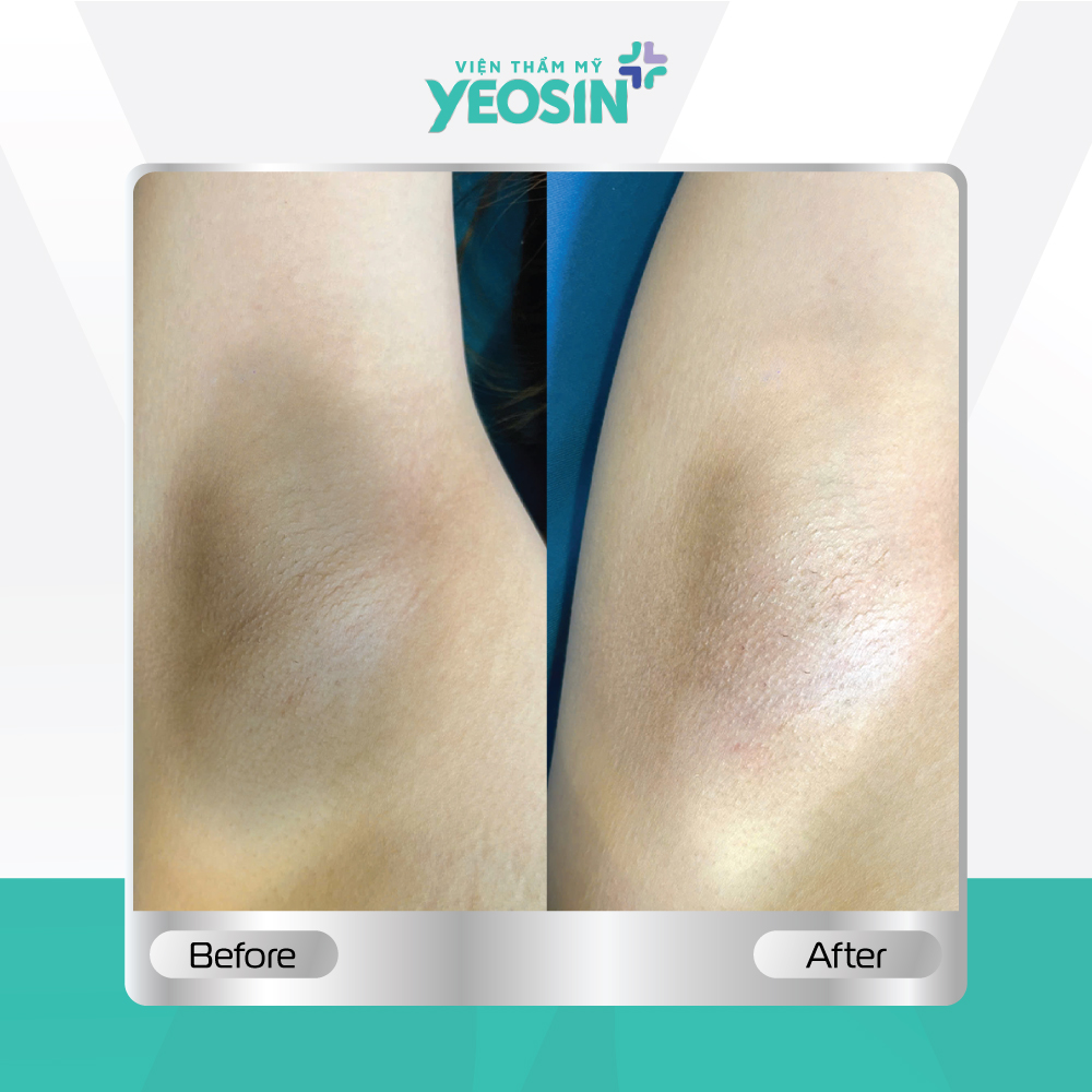 Hình fb từ khách hàng 05