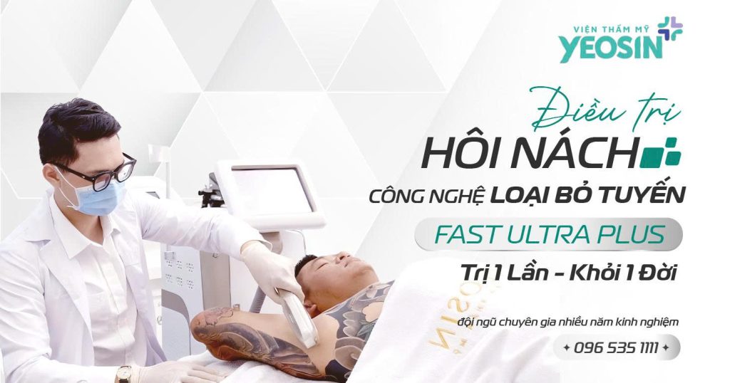 Trị hôi nách loại bỏ tuyến Yeosin