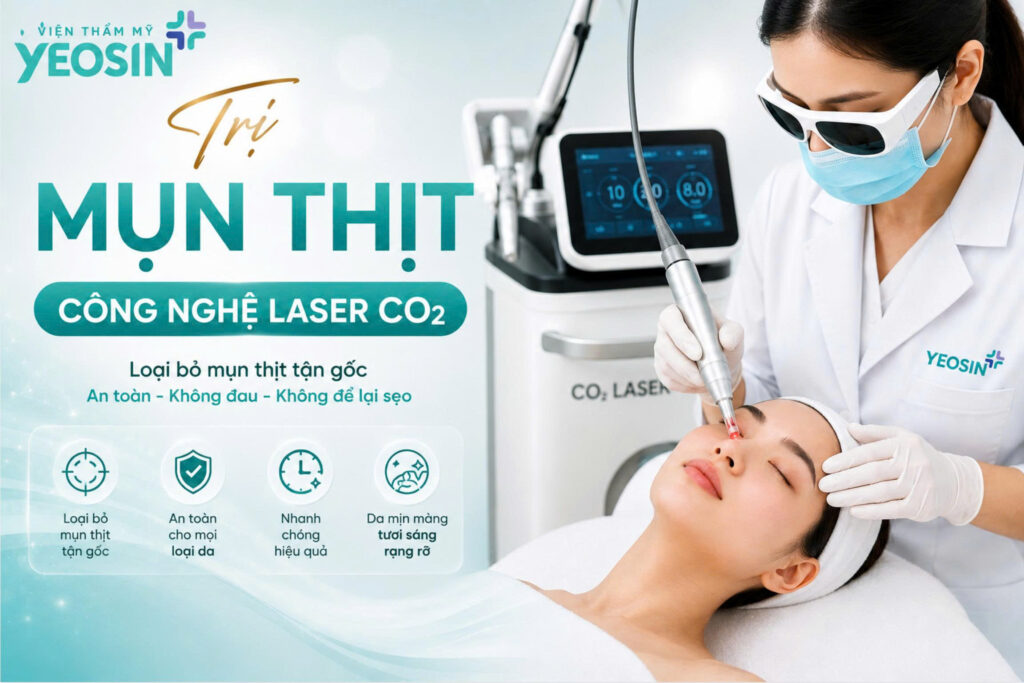 Điều trị mụn thịt hiệu quả bằng công nghệ Laser CO2 tại Yeosin