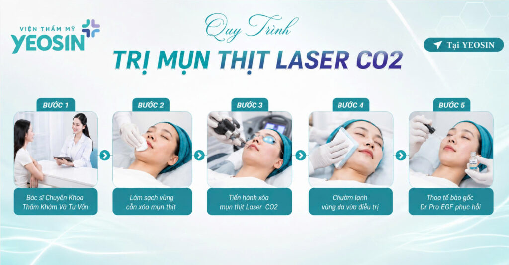 Quy trình điều trị mụn thịt bằng Công nghệ Laser CO2