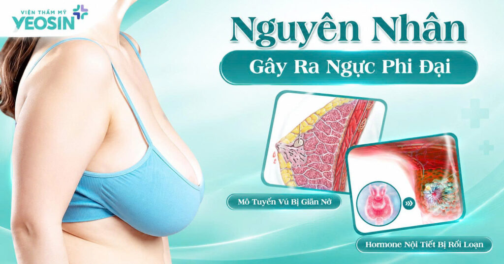 Nâng ngực - Thu gọn ngực phì đại bằng phương pháp cắt tuyến 8 1789035052910 543195267361827872 301541920615582086 b539c5b239ad679395587d96031ed488