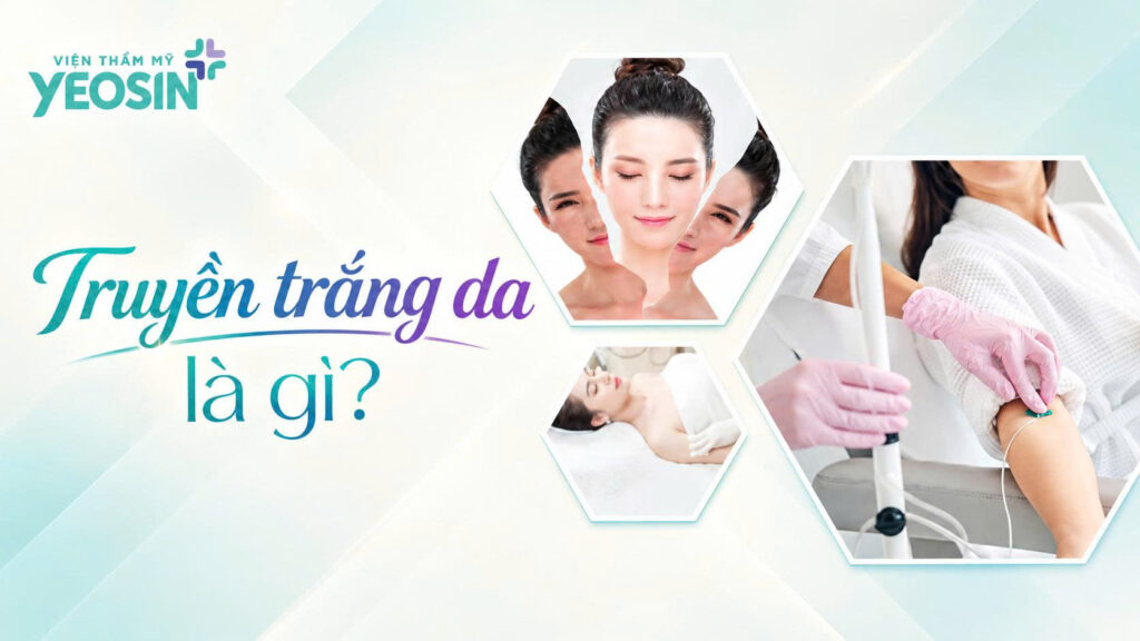 Truyền trắng da là gì? Những điều cần biết truyền trắng da an toàn và hiệu quả. 8 Truyền trắng da là gì?