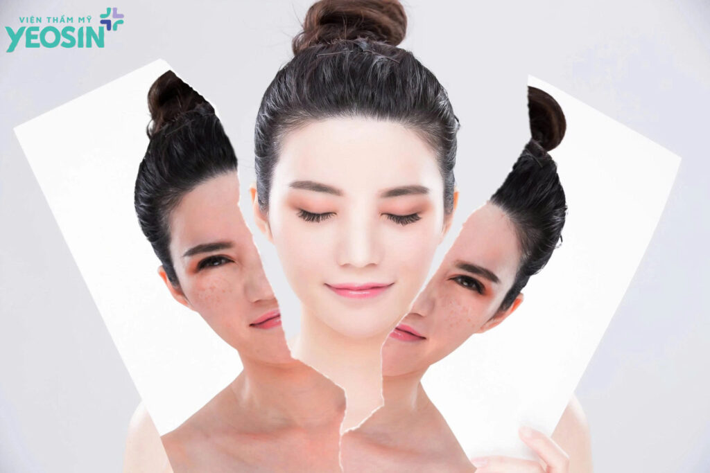 Truyền trắng da là gì? Những điều cần biết truyền trắng da an toàn và hiệu quả. 9 Phân biệt tiêm trắng và truyền trắng da