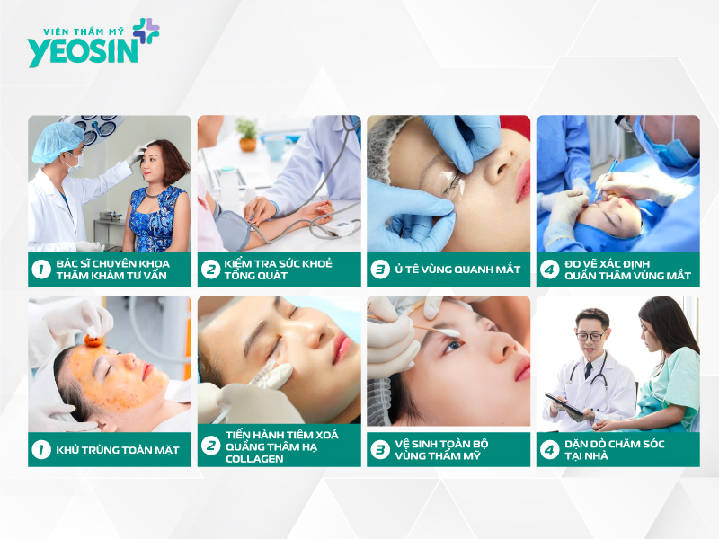 Quy trình xóa thâm quầng mắt bằng công nghệ HA Collagen