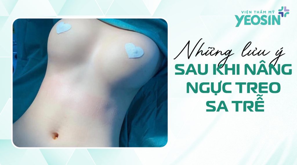 Những lưu ý sau khi sử dụng dịch vụ phẫu thuật treo sa trễ