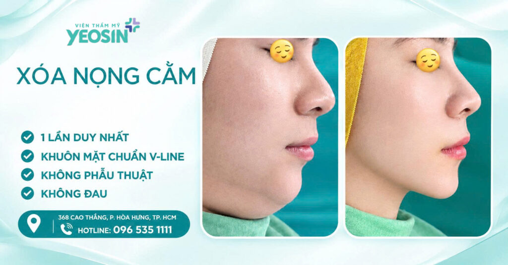 5 Cách giảm mỡ nọng cằm hiệu quả nhanh hiện nay 17 590A5FF1 956E 4311 A1C4 617586D2516E