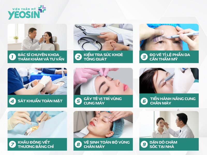 #5 kỹ thuật nâng cung chân mày phổ biến hiện nay 16 Quy trình nâng cung chân mày tại Yeosin