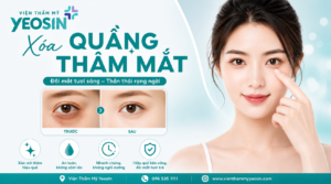 Xóa thâm quầng mắt