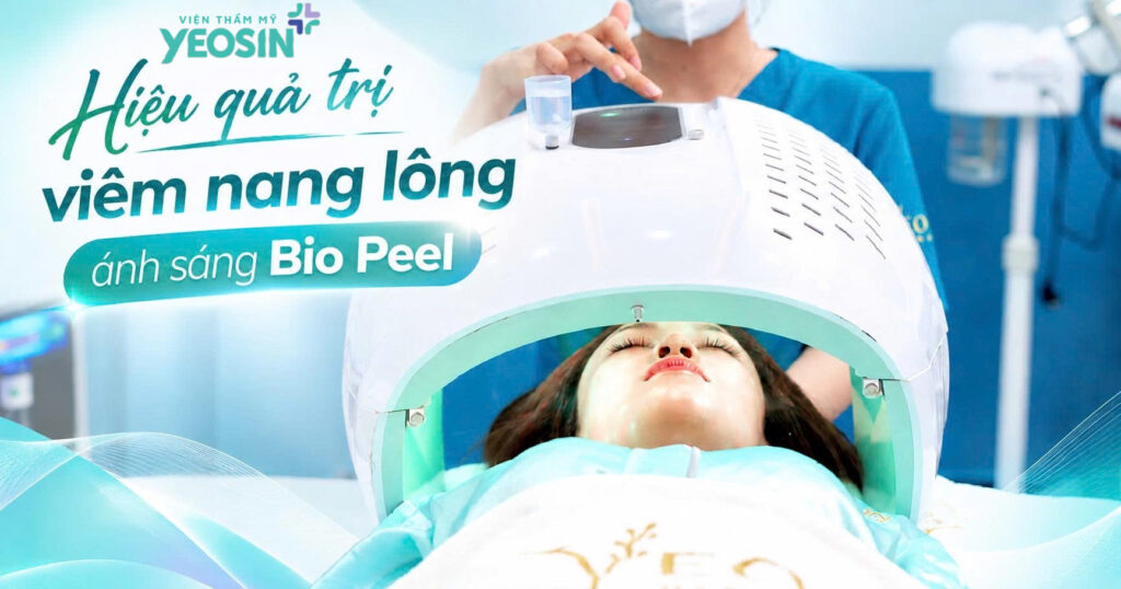 Hiệu quả nhận được khi trị viêm nang lông tại Yeosin 96232253 C87C 4161 9616 E1475DC5C253