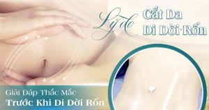 cắt da di dời rốn viện thẩm mỹ yeosin