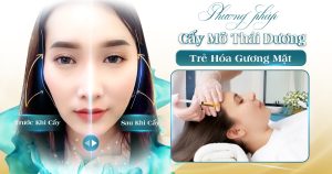 BANNER BAI VIET BIA CAY MO THAI DUONG