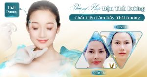phương pháp độn chất liệu thái dương