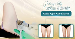 giảm mỡ đùi viện thẩm mỹ yeosin