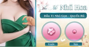 thu nhỏ nhũ hoa