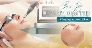 trị mụn thịt viện thẩm mỹ yeosin