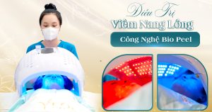 BANNER BAI VIET BIA TRI VIEM NANG LONG BANG BIO PEEL F