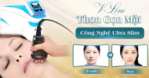 Làm thon gọn vùng mặt tại viện thẩm mỹ yeosin