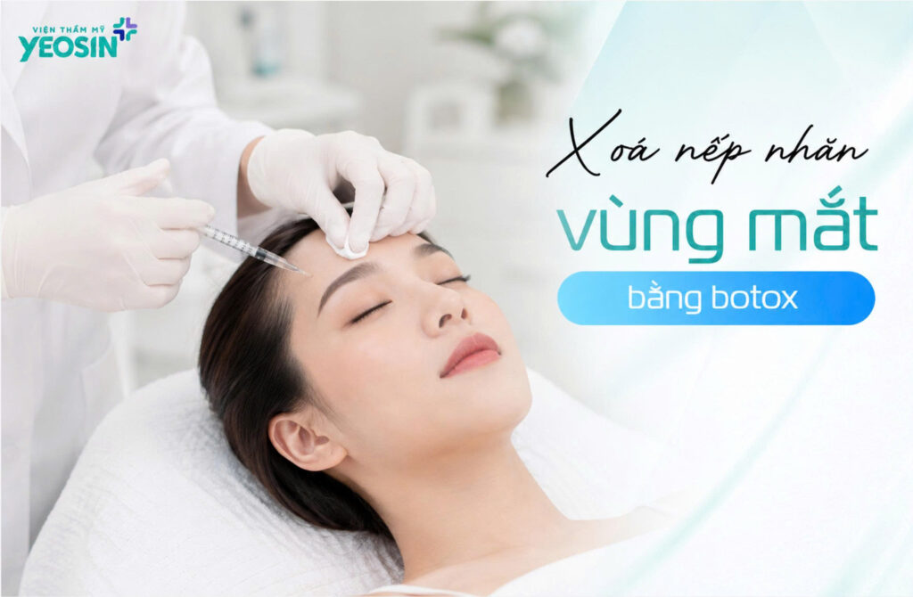 Co che xoa nhan mat cua Botox