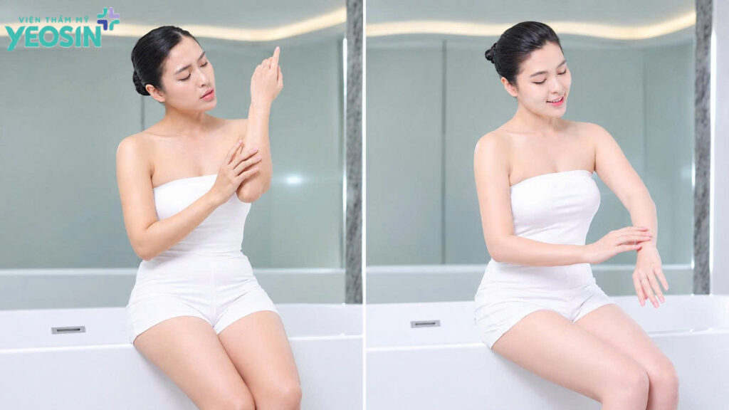 Truyền trắng da là gì? Những điều cần biết truyền trắng da an toàn và hiệu quả. 10 Truyền trắng da có hiệu quả không?