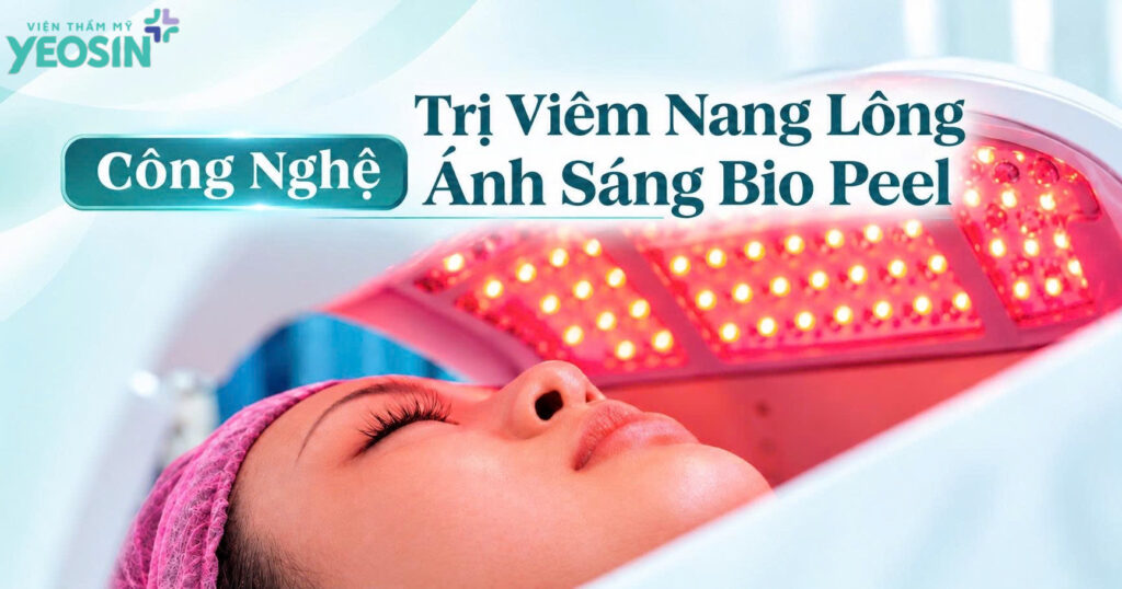 Điều trị viêm nang lông bằng Ánh Sáng Sinh Học Bio Peel 9 E8EF3EB1 980F 483E 9872 C1E30973DCF9