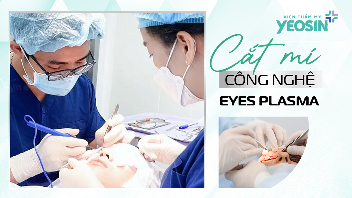 Cắt Mí Bằng Công Nghệ Eyes Plasma Có An Toàn Không? 7 HINH MUC 1