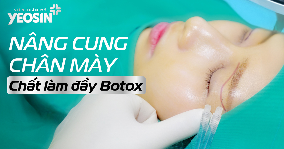 #5 kỹ thuật nâng cung chân mày phổ biến hiện nay 13 HINH MUC 2.41
