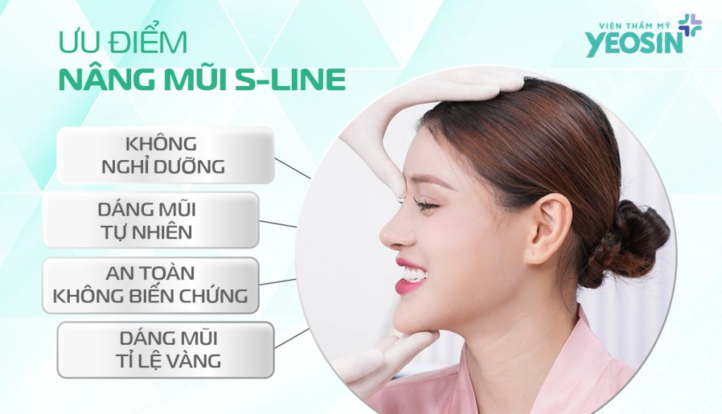 Các ưu điểm của phương pháp nâng mũi S Line