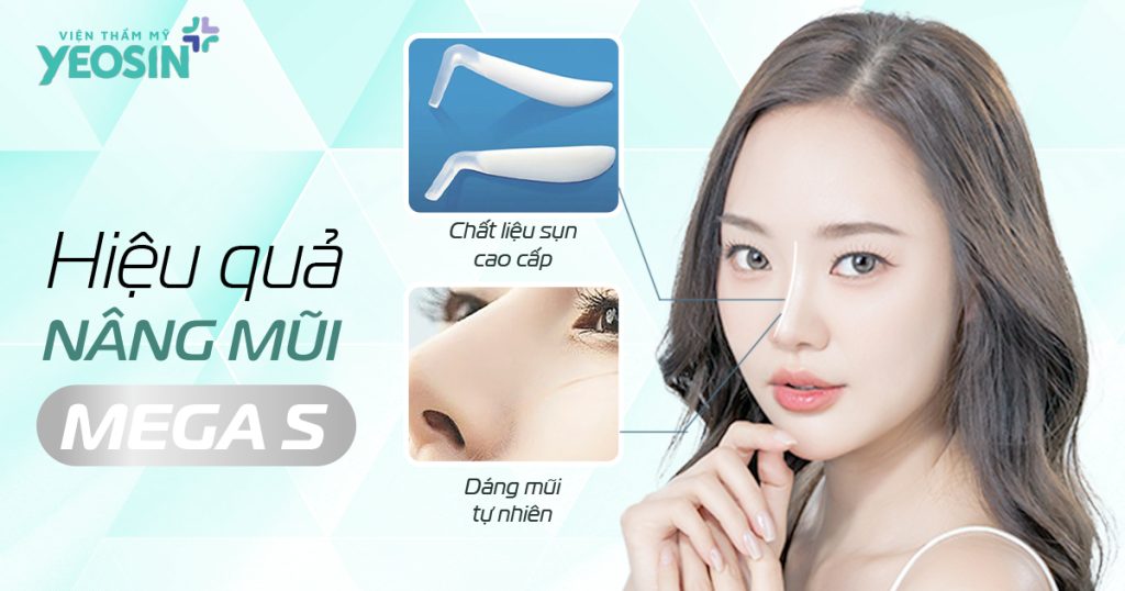 Ưu điểm nổi bật của dịch vụ nâng mũi cấu trúc Mega S
