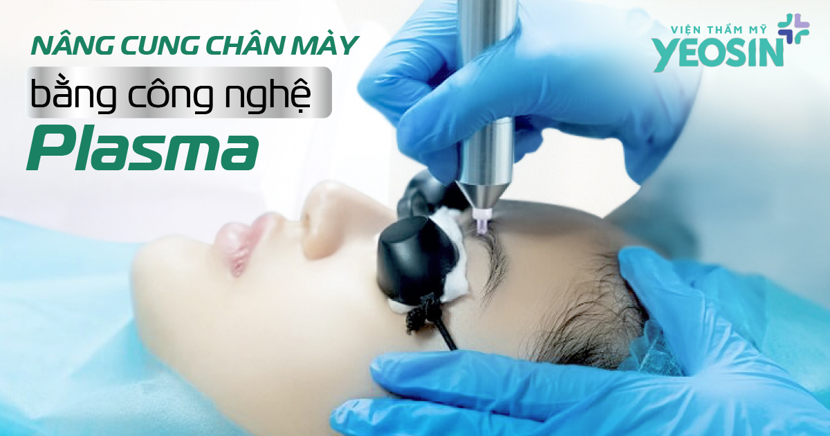 #5 kỹ thuật nâng cung chân mày phổ biến hiện nay 15 HINH MUC 3 3