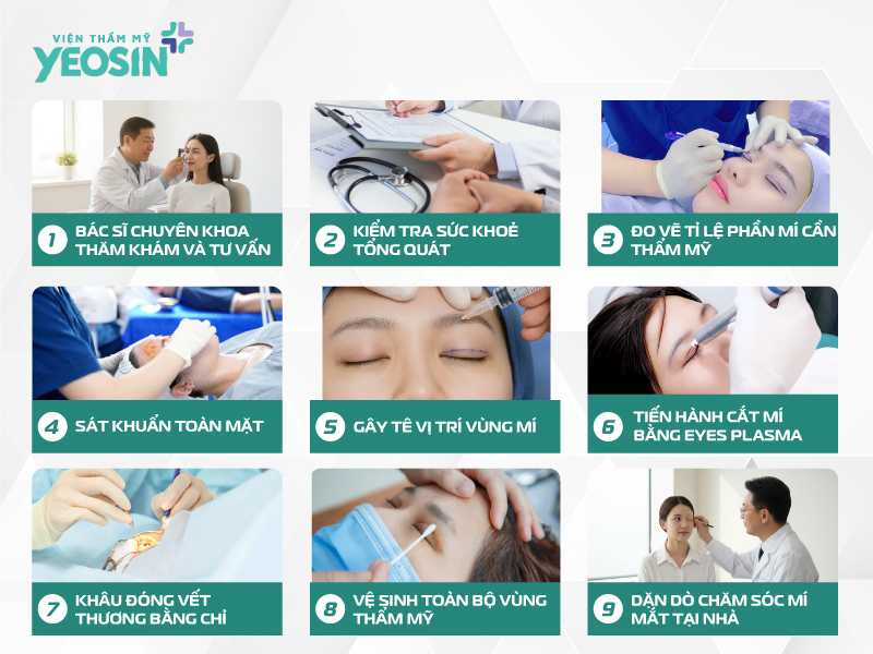 Cắt Mí Bằng Công Nghệ Eyes Plasma Có An Toàn Không? 11 HINH MUC 4.1