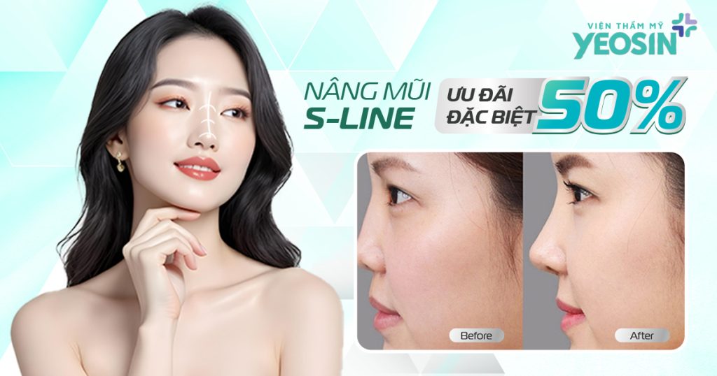 Chi phí nâng mũi S line tại Viện Thẩm Mỹ Yeosin