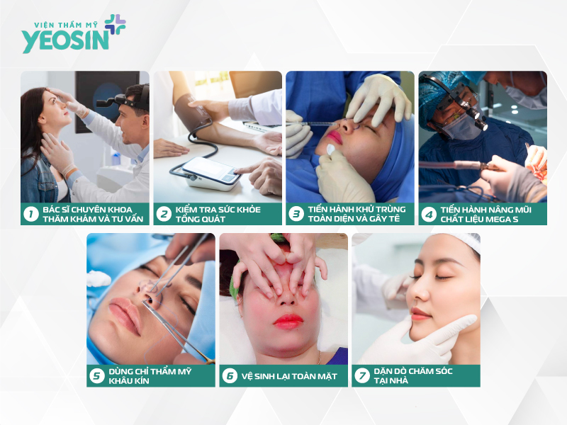 Quy trình thực hiện nâng mũi cấu trúc Mega S tại Viện Thẩm Mỹ Yeosin