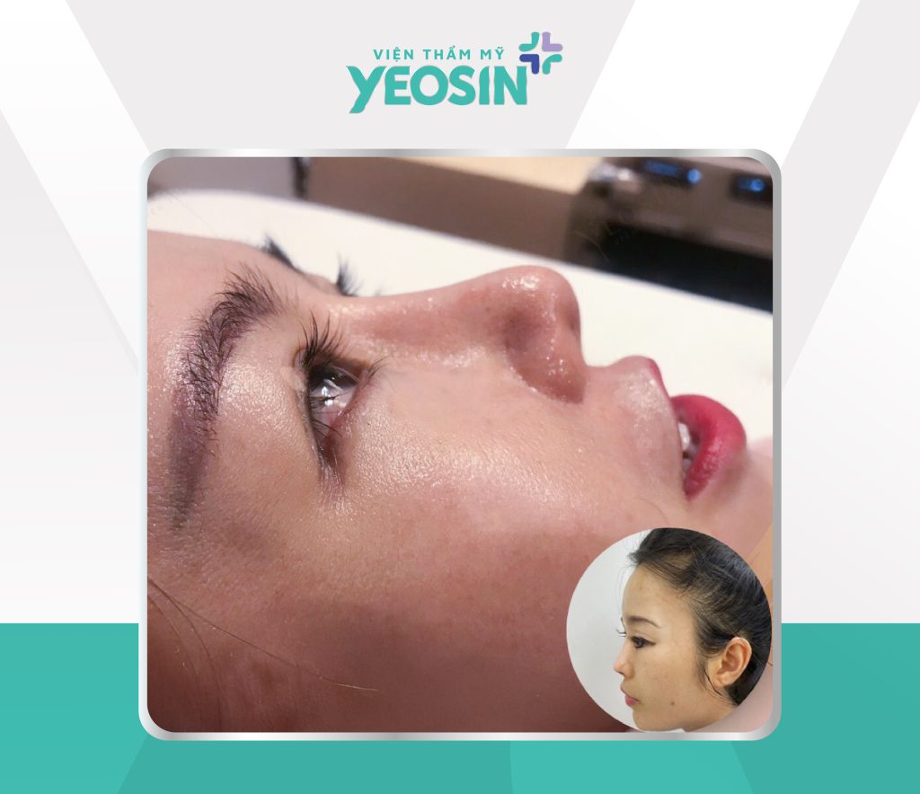 Hình trước sau 02