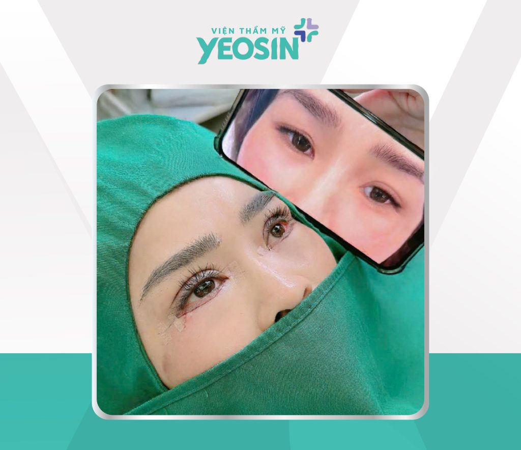 Hình trước sau 09