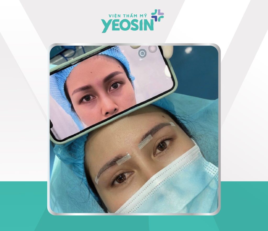 Hình ảnh khách hàng nâng cung chân mày hiệu quả tại Yeosin