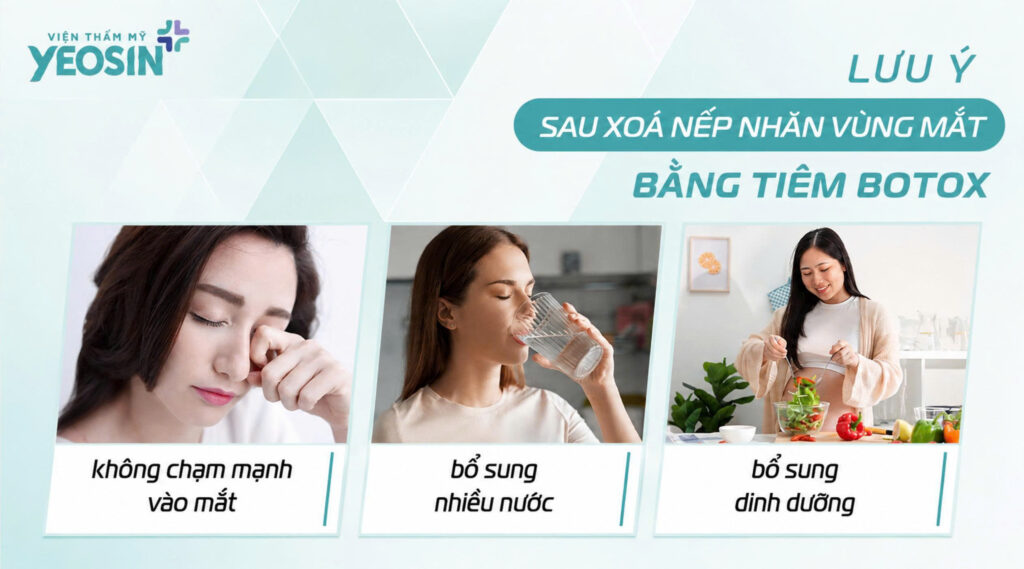 Luu y sau khi xoa nhan mat bang Botox