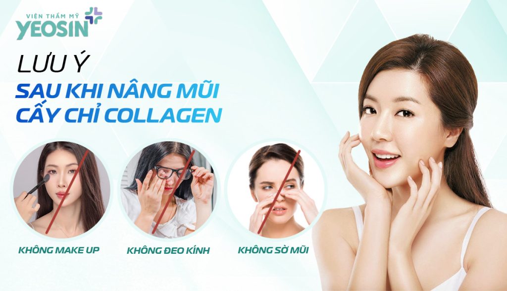 Lưu ý sau khi nâng mũi bằng chỉ collagen