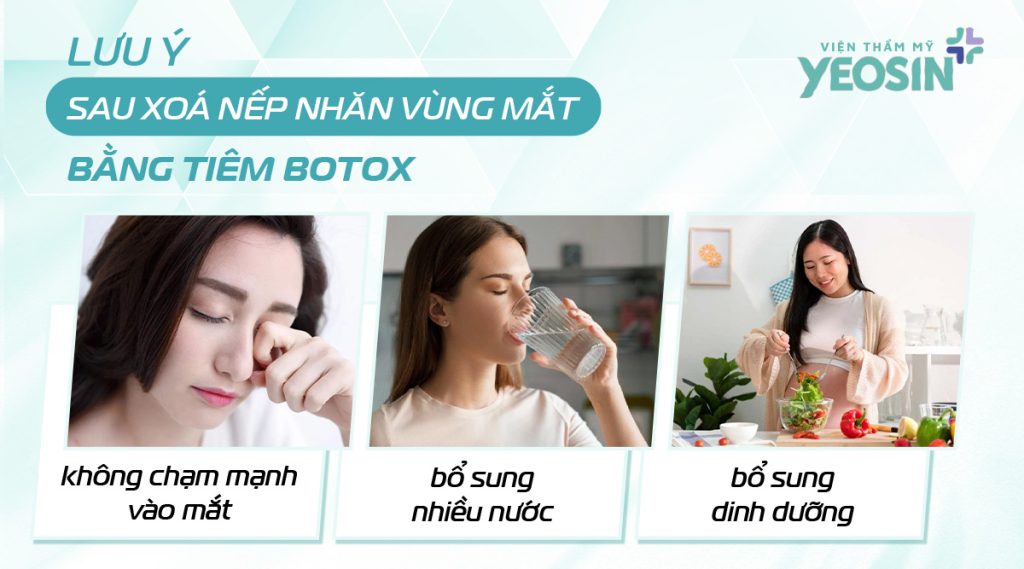 Lưu ý sau khi xóa nhăn bằng Botox