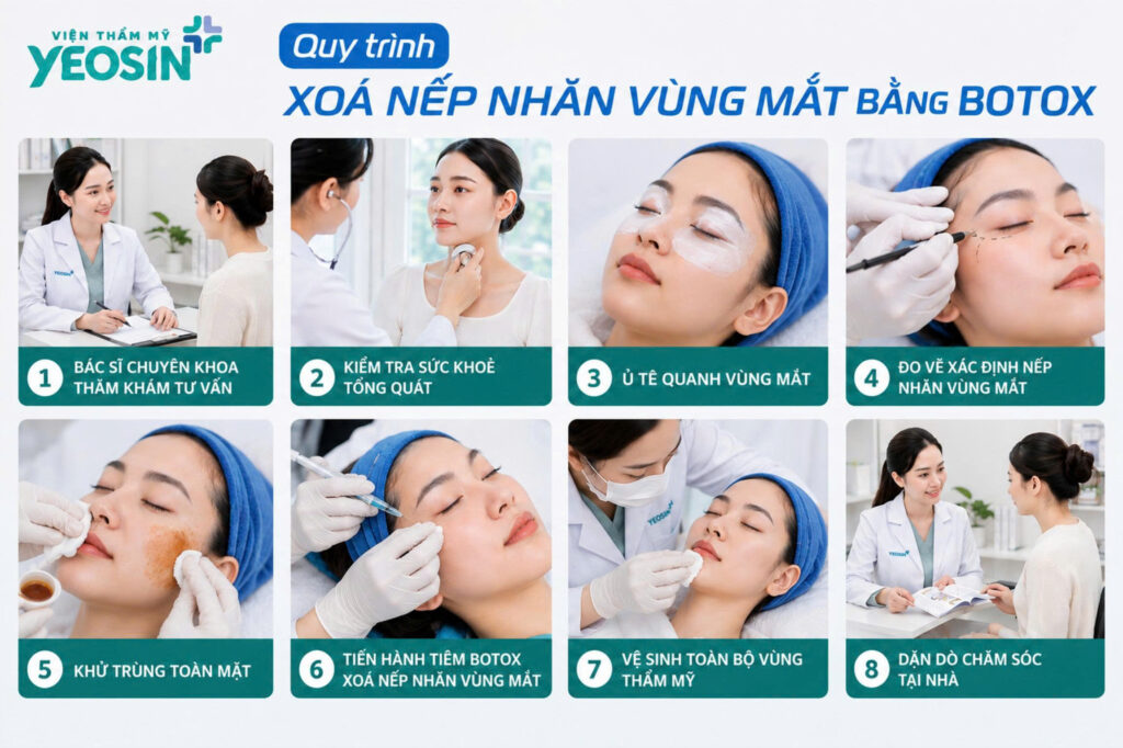 Quy trinh xoa nhan mat bang Botox tai Yeosin