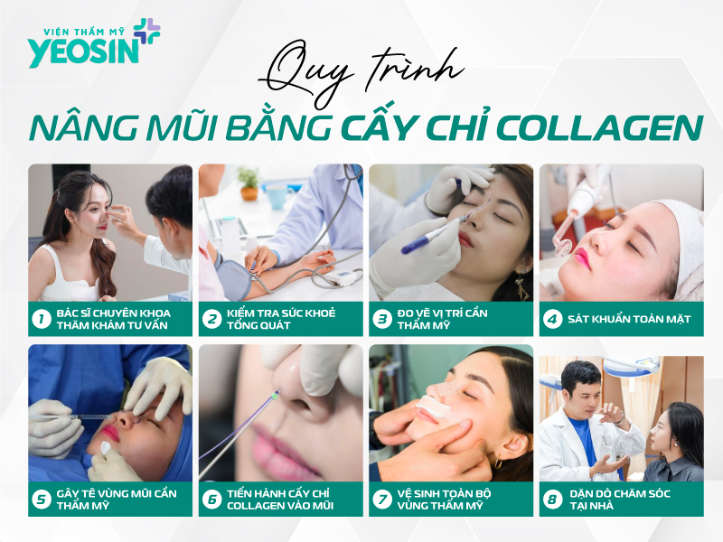 Quy trình nâng mũi bằng chỉ collagen tại Yeosin