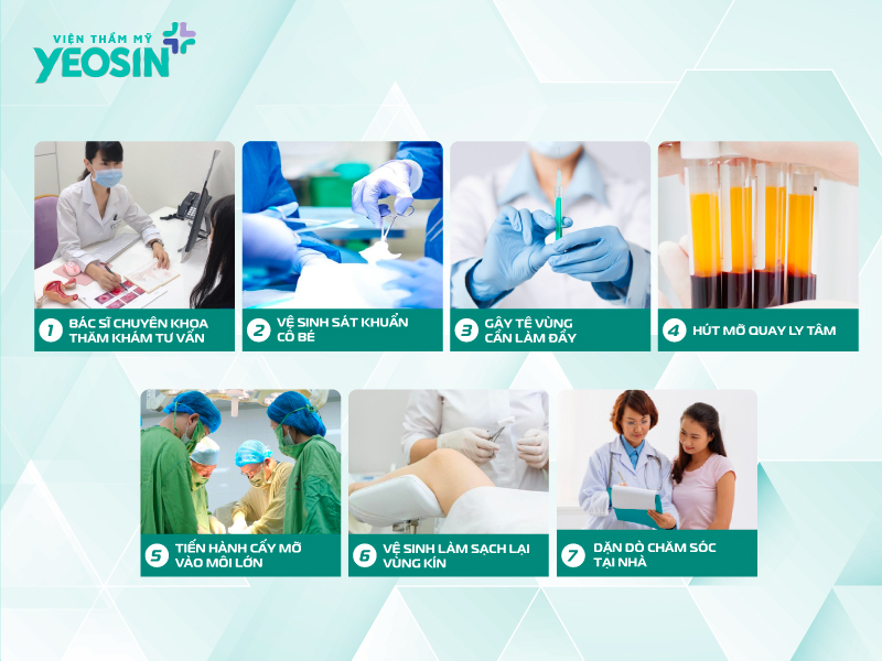 Quy trình thực hiện trẻ hóa môi lớn tại Viện Thẩm Mỹ Yeosin