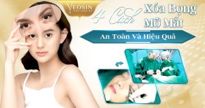 cach xoa mo bong mat hieu qua tai nha