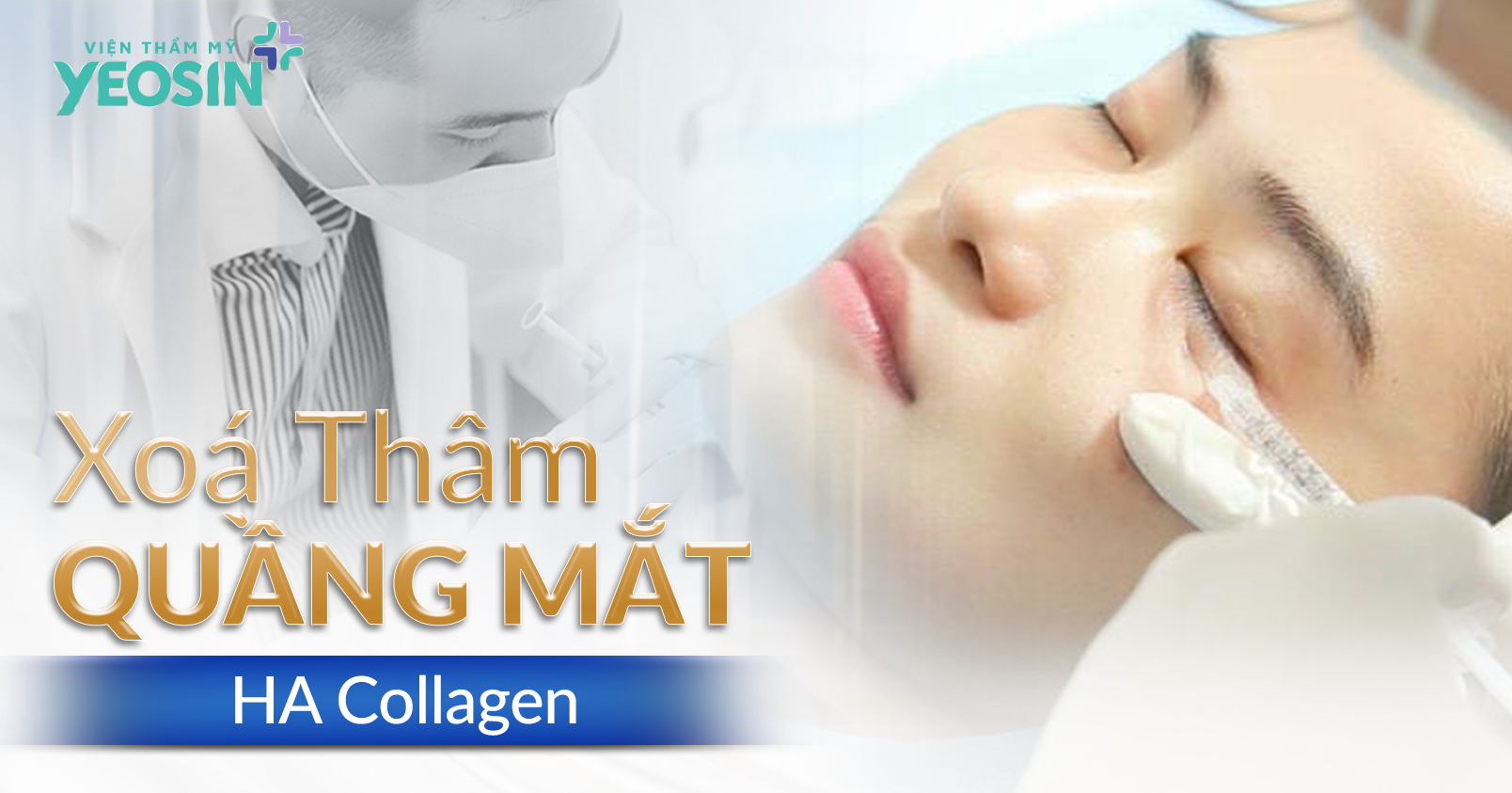 Xóa thâm quầng mắt