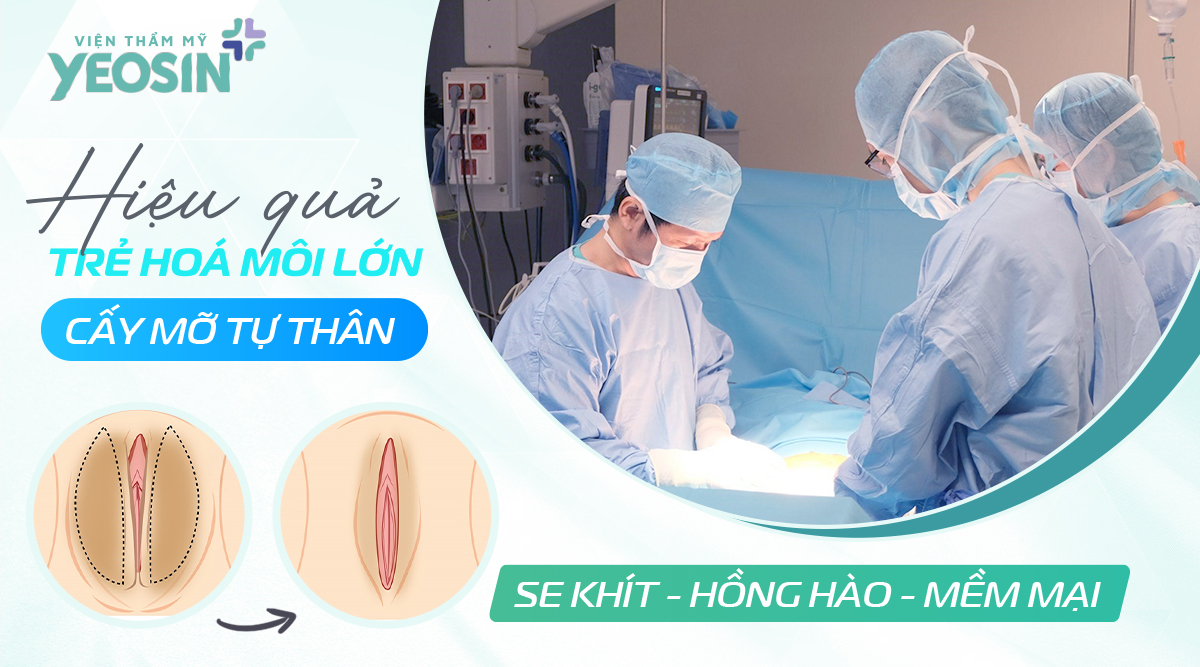 Ưu điểm nổi bật khi trẻ hóa môi lớn bằng mỡ tự thân