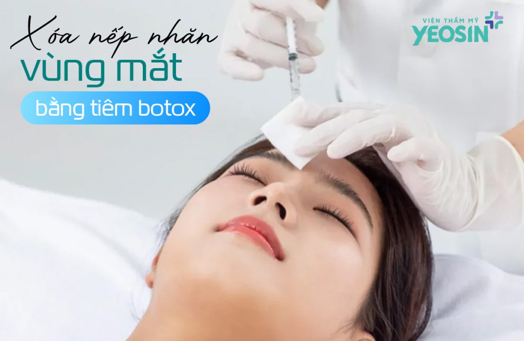 Cơ chế xóa nhăn vùng mắt của Botox