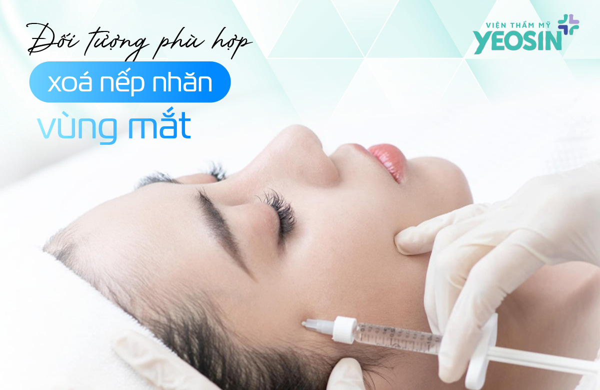 Đối tượng phù hợp xóa nhăn bằng Botox