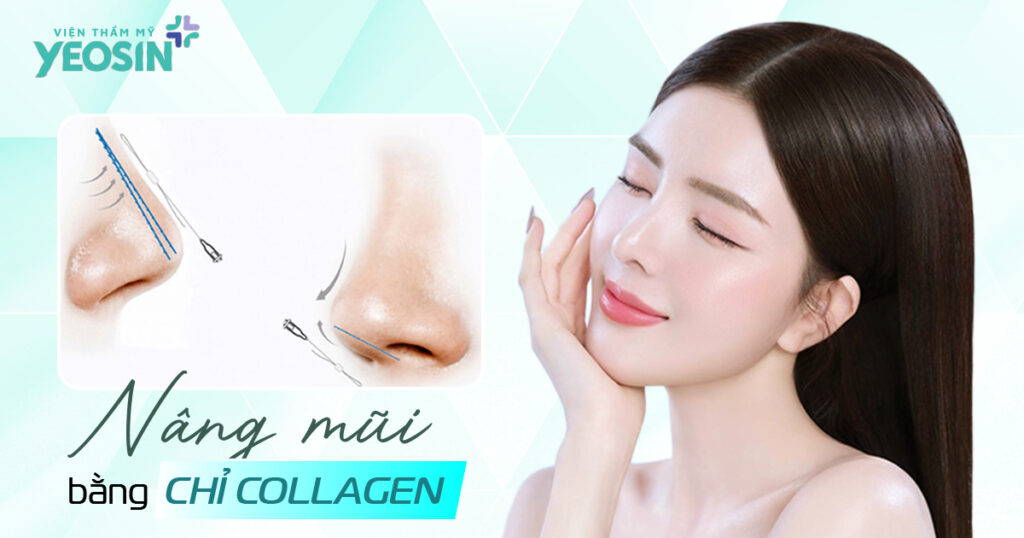 Cơ chế hoạt động của công nghệ nâng mũi bằng chỉ collagen