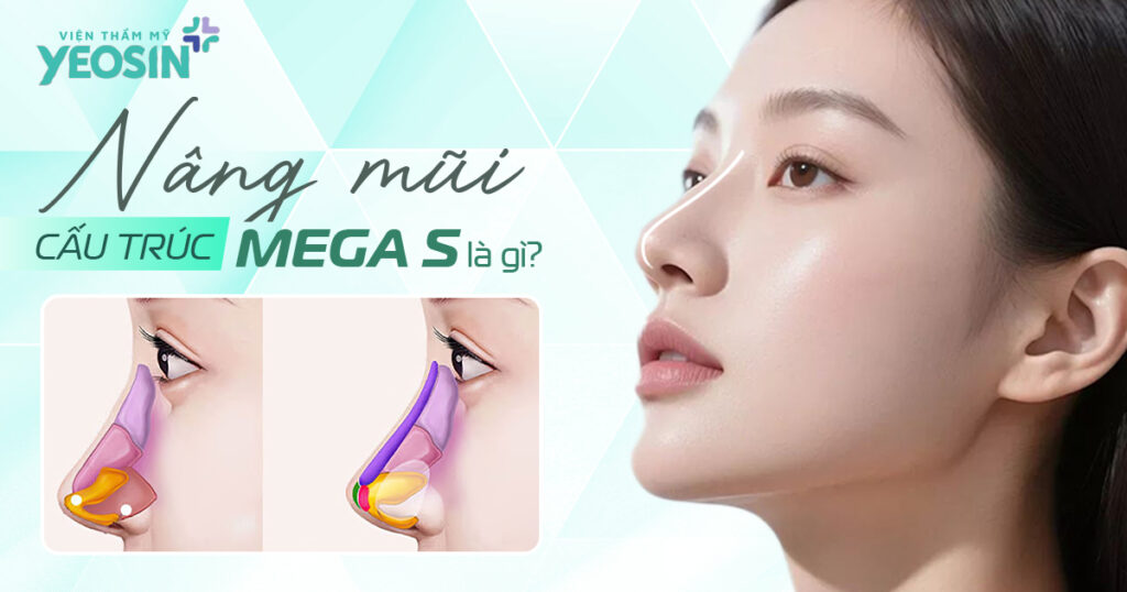 Nâng mũi cấu trúc Mega S là gì?