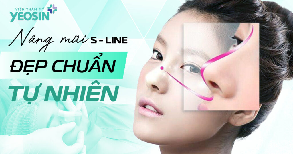 Đặc điểm của dáng mũi S Line và các phương pháp nâng mũi phổ biến